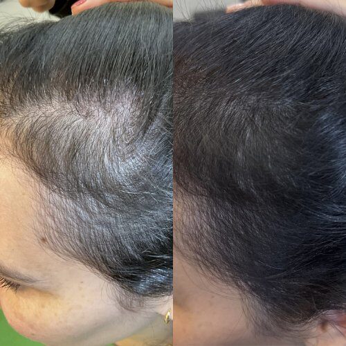 Resultado feminino · antes